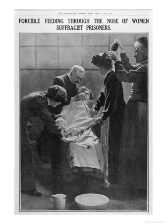 Forcible Feeding Through the Nose of Women Suffragist Prisoners